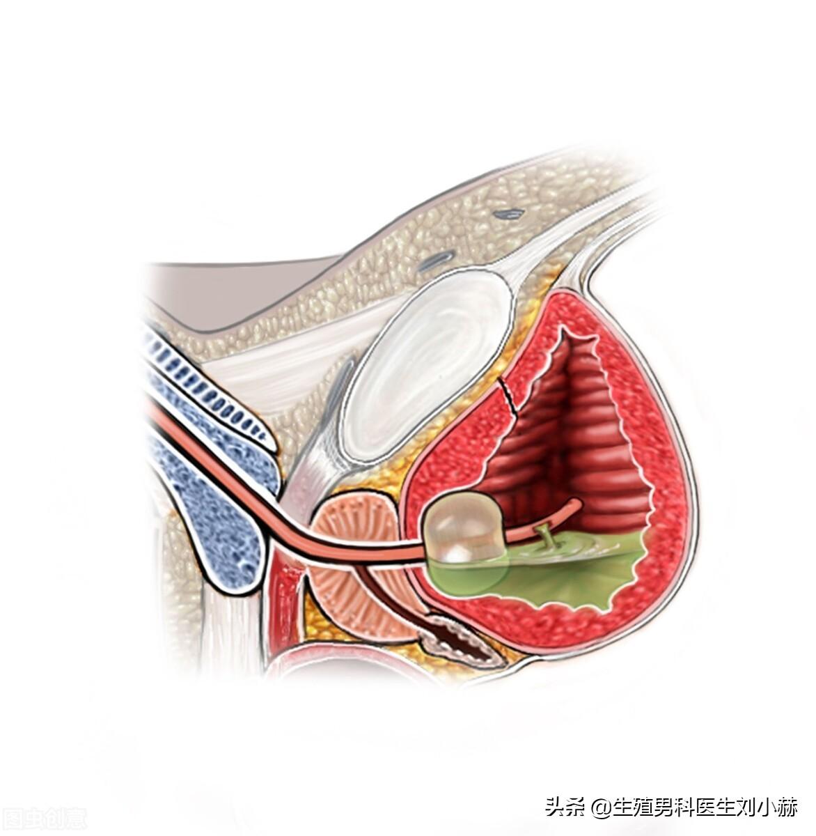 一文读懂前列腺