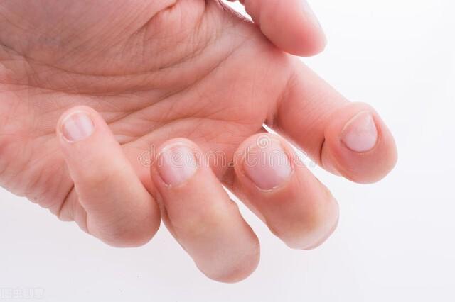 身体有疾，指甲知道？指甲出现6种异常或与疾病相关，别大意