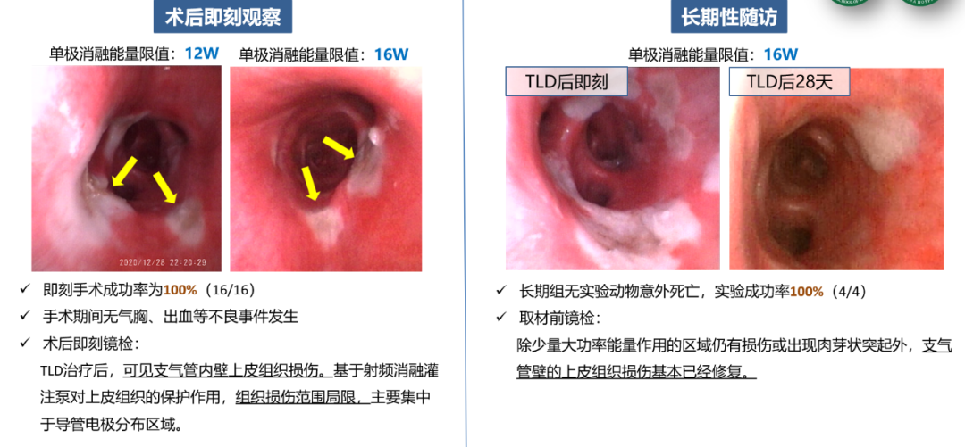 神经阻断术有什么副作用_神经阻断术_神经阻断术类的手术