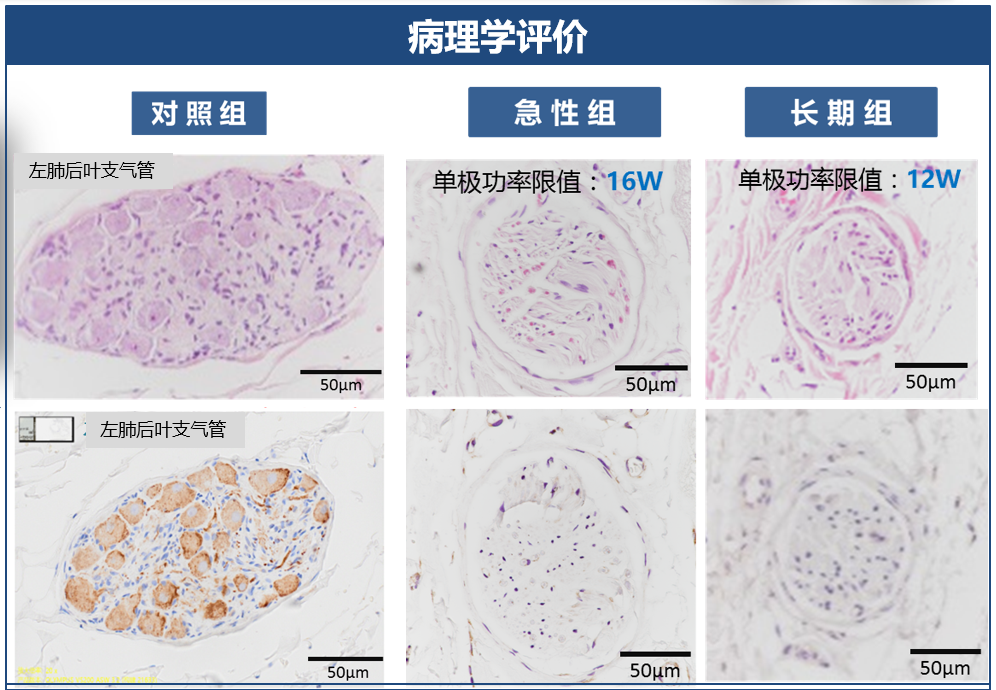 神经阻断术有什么副作用_神经阻断术类的手术_神经阻断术