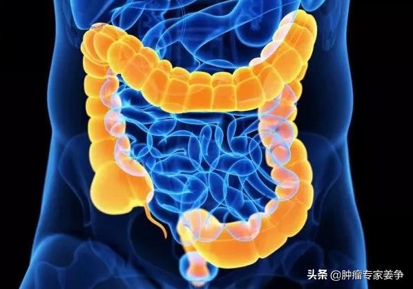 浙江一17岁学生确诊肠癌 17岁学生确诊肠癌