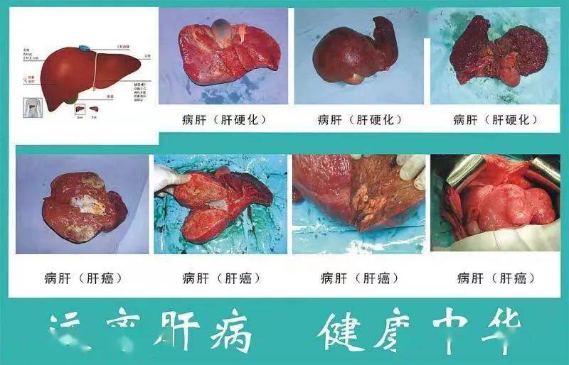 病毒是什么_病毒是生物吗_病毒是由什么构成的