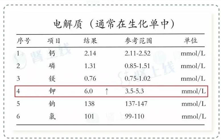 肾病_肾病饮食_肾病综合症是什么病